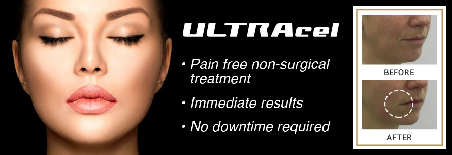 ULTRAcel | Non Surgical Skin Tightening | Dr Rita Rakus Clinic